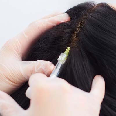 Cabelo e Couro Cabeludo