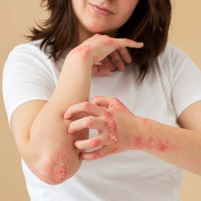 Doenças da pele