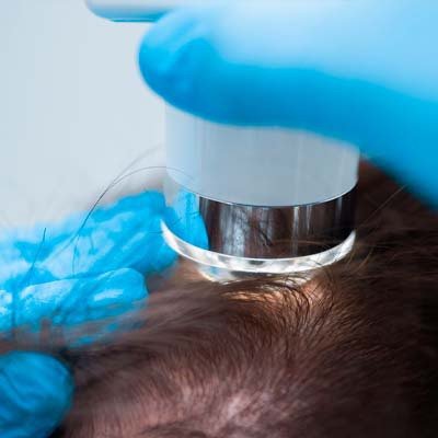 Cabelo e Couro Cabeludo